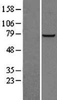 Western Blot: PFKL Overexpression Lysate [NBL1-14314]