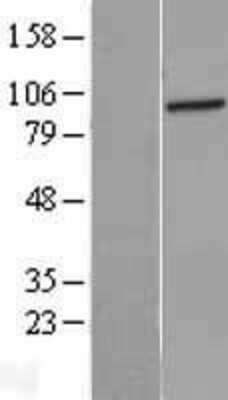 Western Blot: PFKL Overexpression Lysate [NBL1-14315]