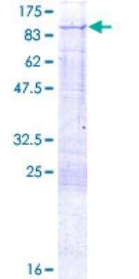 SDS-PAGE: Recombinant Human PFKL GST (N-Term) Protein [H00005211-P01]