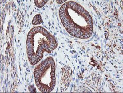 Immunohistochemistry-Paraffin: PFKP Antibody (OTI1D6) [NBP2-01539]