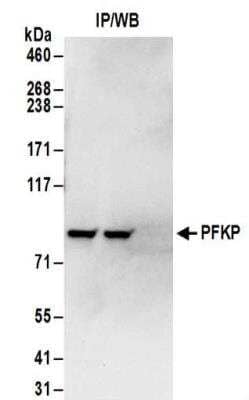 Immunoprecipitation: PFKP Antibody [NBP2-32083]