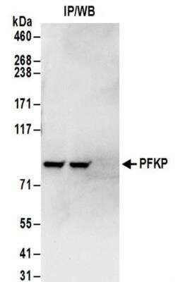 Immunoprecipitation: PFKP Antibody [NBP2-32192]