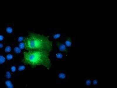 Immunocytochemistry/ Immunofluorescence: PFKP Antibody (OTI1D6) - Azide and BSA Free [NBP2-73344]