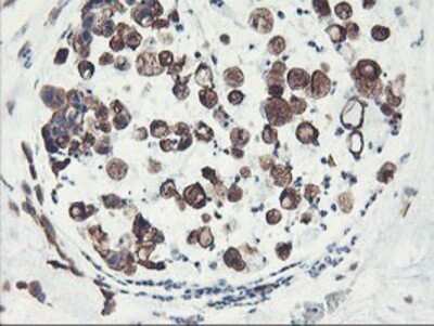 Immunohistochemistry: PFKP Antibody (OTI1D6) - Azide and BSA Free [NBP2-73344]