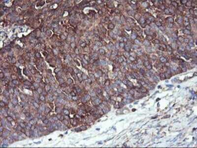Immunohistochemistry: PFKP Antibody (OTI1D6) - Azide and BSA Free [NBP2-73344]