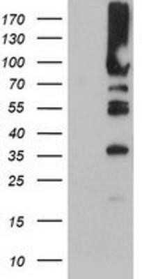 Western Blot: PFKP Antibody (OTI1D6)Azide and BSA Free [NBP2-73344]