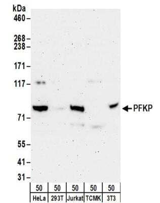 Western Blot: PFKP Antibody [NBP2-32192]