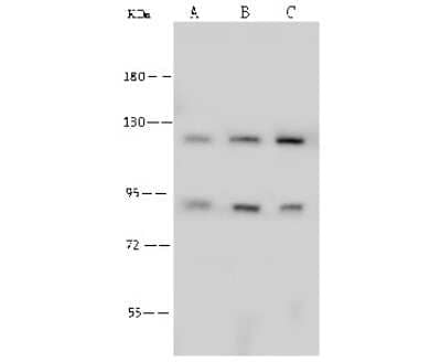 Western Blot: PFKP Antibody [NBP2-99101]