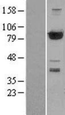 Western Blot: PFKP Overexpression Lysate [NBL1-14317]