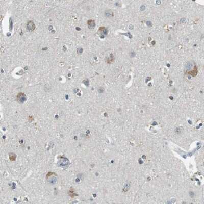 Immunohistochemistry-Paraffin: PFTK1 Antibody [NBP1-80920]