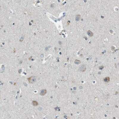 Immunohistochemistry-Paraffin: PFTK1 Antibody [NBP1-80920]