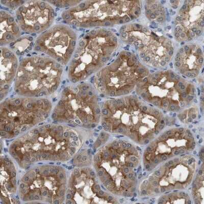 Immunohistochemistry-Paraffin: PFTK1 Antibody [NBP1-80920]