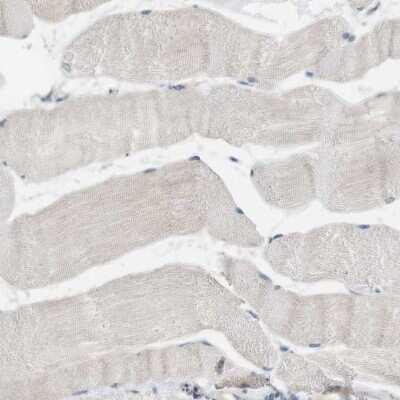 Immunohistochemistry-Paraffin: PFTK1 Antibody [NBP1-80920]