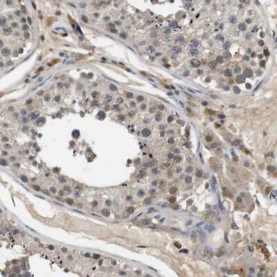 Immunohistochemistry-Paraffin: PFTK1 Antibody [NBP1-80920]