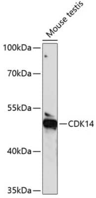 Immunohistochemistry-Paraffin: PFTK1 Antibody - Azide and BSA Free [NBP3-03671]