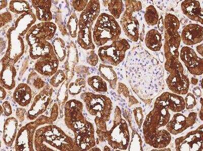 Immunohistochemistry-Paraffin: PFTK1 Antibody [NBP3-06062]