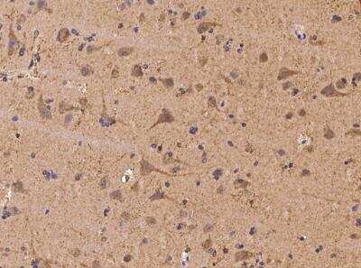 Immunohistochemistry-Paraffin: PFTK1 Antibody [NBP3-06062]