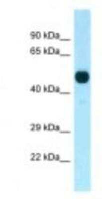 Western Blot: PFTK1 Antibody [NBP1-98270]