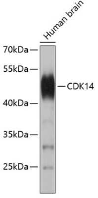 Western Blot: PFTK1 AntibodyAzide and BSA Free [NBP2-94848]