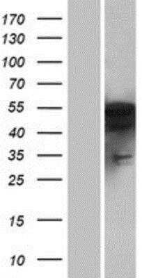 Western Blot: PFTK1 Overexpression Lysate [NBP2-07451]