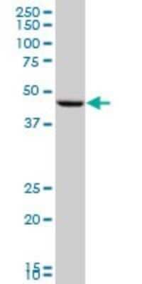 Western Blot: PGA5 Antibody (4G9) [H00005222-M02]