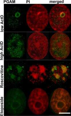 Immunocytochemistry/ Immunofluorescence: PGAM1/2/4 Antibody [NB100-774]