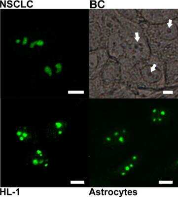 Immunocytochemistry/ Immunofluorescence: PGAM1/2/4 Antibody [NB100-774]