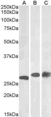 Western Blot: PGAM1/2/4 Antibody [NB100-774]