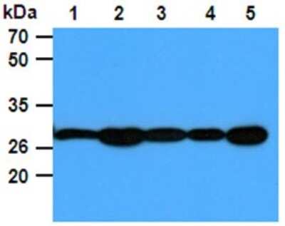 Western Blot: PGAM1 Antibody (1G4)BSA Free [NBP2-59418]