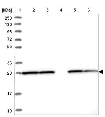 Western Blot: PGAM1 Antibody [NBP2-46676]