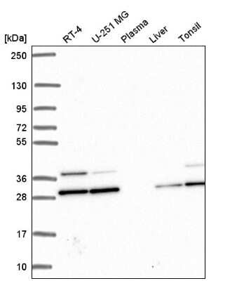 Western Blot: PGAM1 Antibody [NBP2-56569]