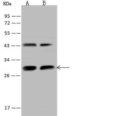 Western Blot: PGAM1 Antibody [NBP2-97513]