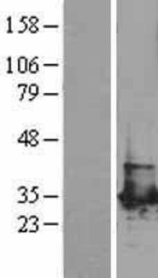 Western Blot: PGAM1 Overexpression Lysate [NBL1-14323]