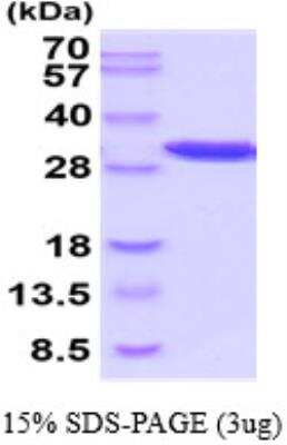 SDS-PAGE: Recombinant Mouse PGAM1 His Protein [NBP2-52614]