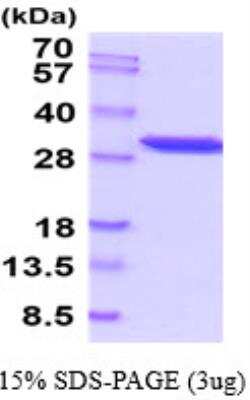 SDS-PAGE: Recombinant Human PGAM1 His Protein [NBP2-52620]