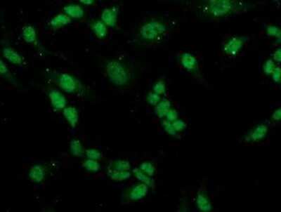 Immunocytochemistry/ Immunofluorescence: PGAM2 Antibody (OTI4E9) [NBP2-01142]