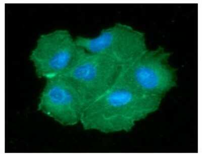 Immunocytochemistry/ Immunofluorescence: PGAM2 Antibody (5A7) - BSA Free [NBP2-59410]
