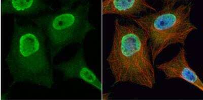 Immunocytochemistry/ Immunofluorescence: PGAM2 Antibody [NBP1-32966]