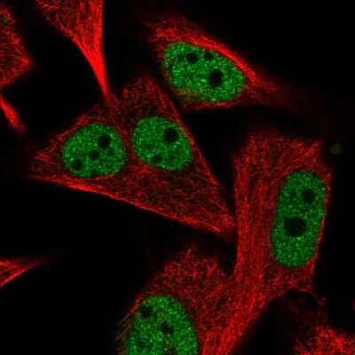 Immunocytochemistry/ Immunofluorescence: PGAM2 Antibody [NBP2-68689]