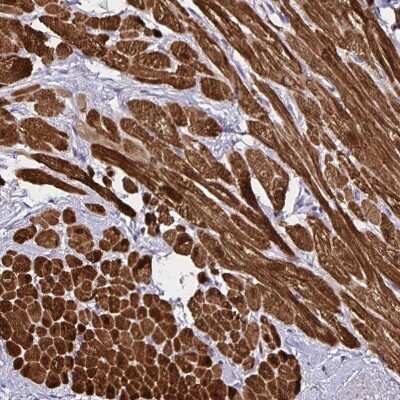 Immunohistochemistry: PGAM2 Antibody [NBP2-38889]