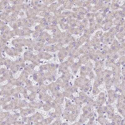 Immunohistochemistry-Paraffin: PGAM2 Antibody [NBP2-38889]