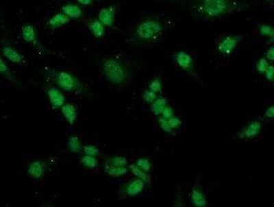 Immunocytochemistry/ Immunofluorescence: PGAM2 Antibody (OTI4E9) - Azide and BSA Free [NBP2-73358]