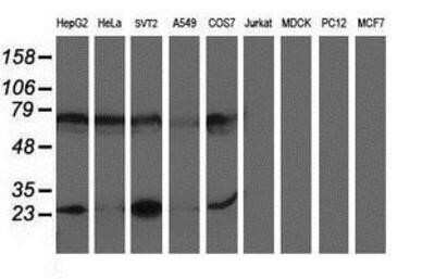 Western Blot: PGAM2 Antibody (OTI4E9)Azide and BSA Free [NBP2-73358]