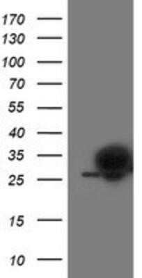 Western Blot: PGAM2 Antibody (OTI4E9)Azide and BSA Free [NBP2-73358]