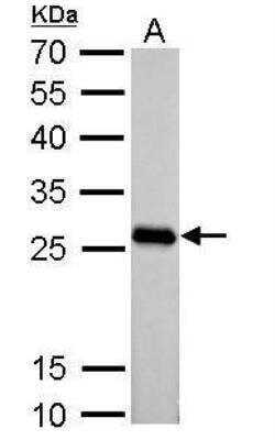 Western Blot: PGAM2 Antibody [NBP1-32966]