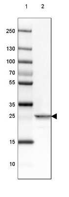 Western Blot: PGAM2 Antibody [NBP2-38889]