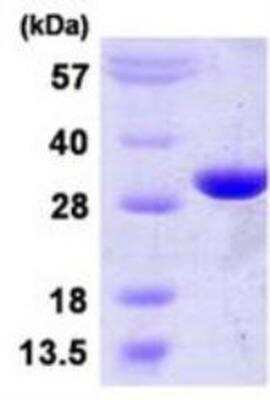 SDS-PAGE: Recombinant Human PGAM2 His Protein [NBP1-99092]