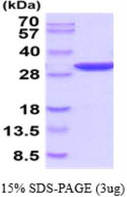 SDS-PAGE: Recombinant Human PGAM2 His Protein [NBP2-52613]