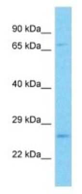 Western Blot: PGAM4 Antibody [NBP3-09875]