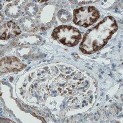 Immunohistochemistry-Paraffin: PGAM5 Antibody (CL0624) [NBP2-52947]